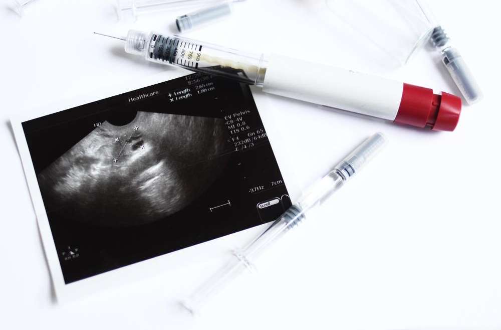 IUI / Artificial Insemination